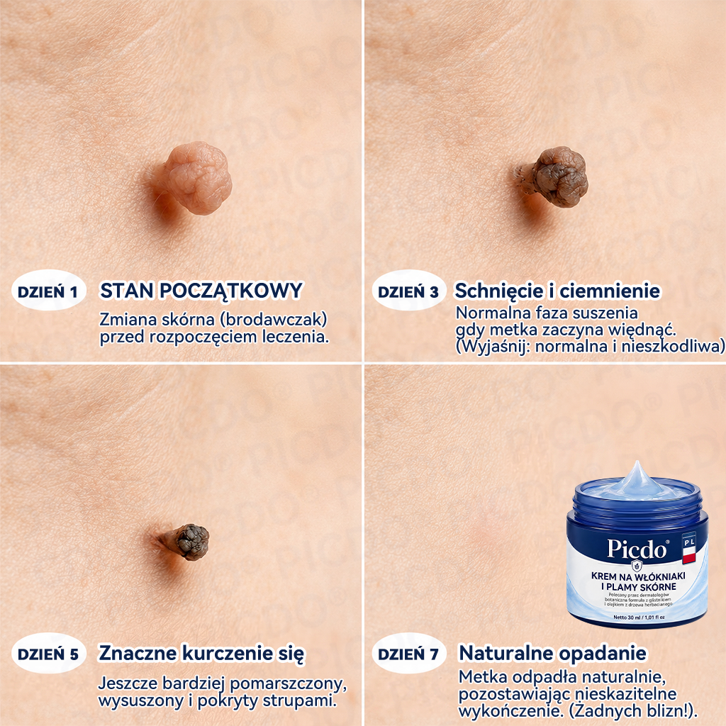 🏥🥼 𝐏𝐢𝐜𝐝𝐨® 7-𝐃𝐧𝐢𝐨𝐰𝐲 𝐊𝐫𝐞𝐦 𝐝𝐨 𝐔𝐬𝐮𝐰𝐚𝐧𝐢𝐚 𝐁𝐫𝐨𝐝𝐚𝐰𝐞𝐤 𝐢 𝐍𝐢𝐞𝐝𝐨𝐬𝐤𝐨𝐧𝐚𝐥𝐨ś𝐜𝐢 𝐒𝐤ó𝐫𝐲🩵 (𝑭𝒐𝒓𝒎𝒖ł𝒂 𝑩𝒆𝒛 𝑩ó𝒍𝒖 𝒊 𝑩𝒆𝒛 𝑩𝒍𝒊𝒛𝒏) 💎