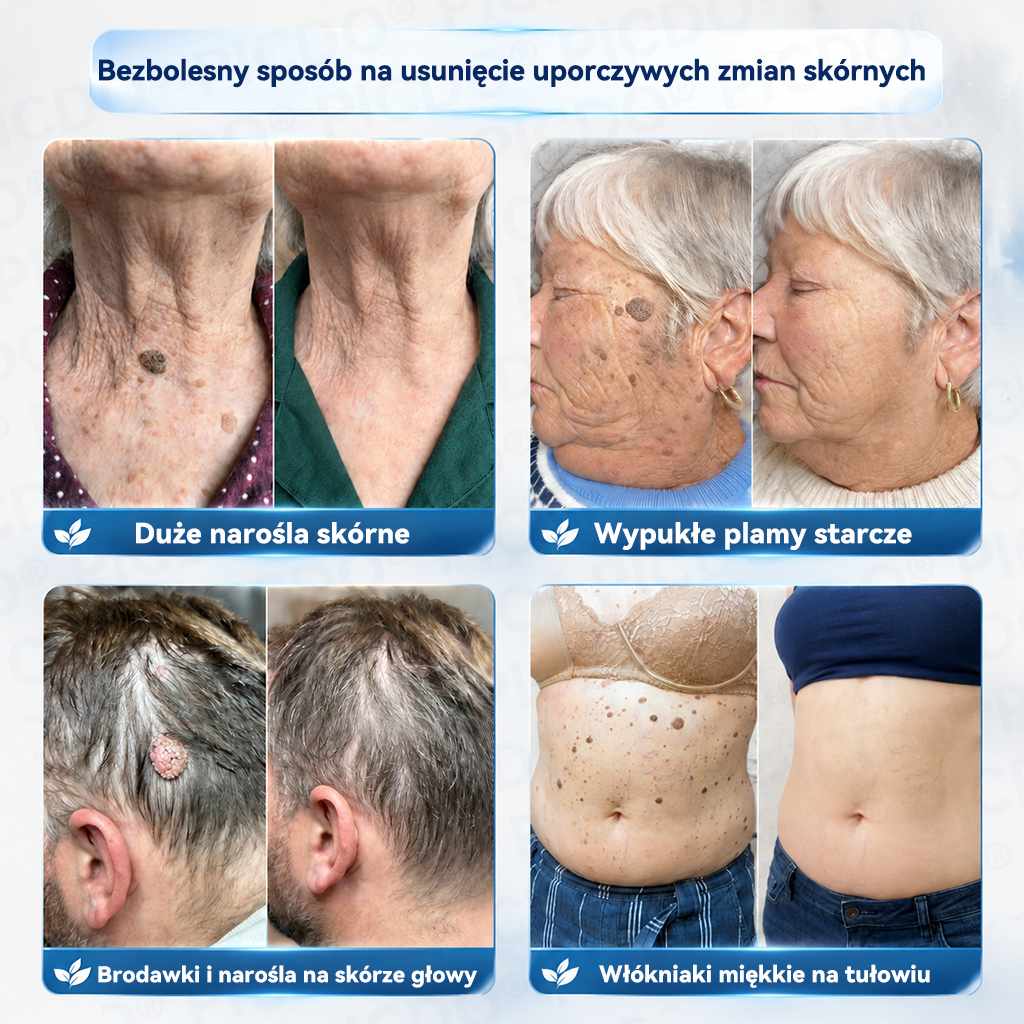 🏥🥼 𝐏𝐢𝐜𝐝𝐨® 7-𝐃𝐧𝐢𝐨𝐰𝐲 𝐊𝐫𝐞𝐦 𝐝𝐨 𝐔𝐬𝐮𝐰𝐚𝐧𝐢𝐚 𝐁𝐫𝐨𝐝𝐚𝐰𝐞𝐤 𝐢 𝐍𝐢𝐞𝐝𝐨𝐬𝐤𝐨𝐧𝐚𝐥𝐨ś𝐜𝐢 𝐒𝐤ó𝐫𝐲🩵 (𝑭𝒐𝒓𝒎𝒖ł𝒂 𝑩𝒆𝒛 𝑩ó𝒍𝒖 𝒊 𝑩𝒆𝒛 𝑩𝒍𝒊𝒛𝒏) 💎